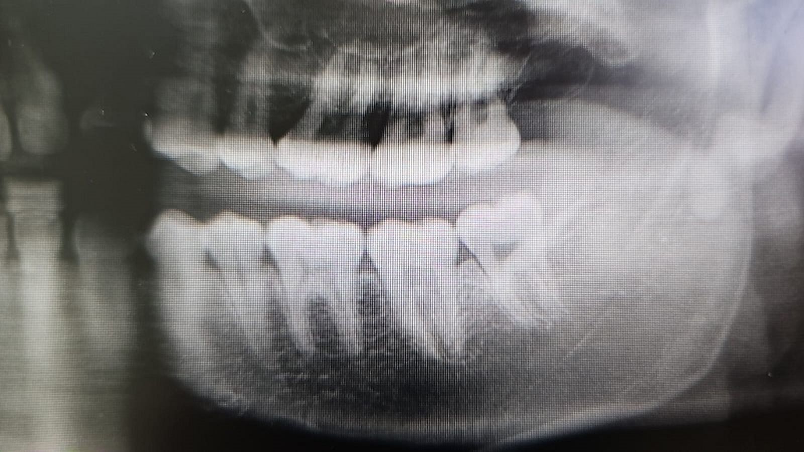 Foto mandíbula de un mayor de edad / CEDIDA