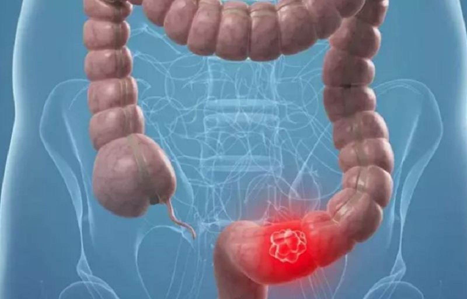 Imagen de archivo. / FOTO E.P.