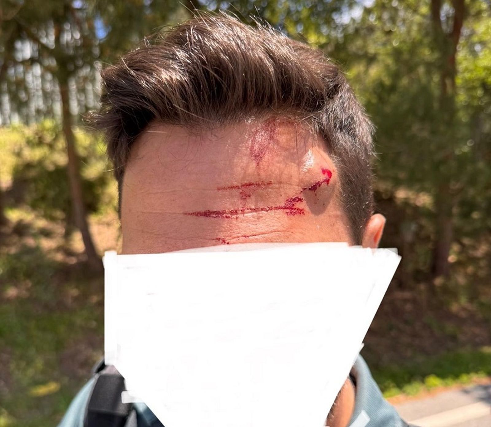El agente de la Guardia Civil tras sufrir la agresión. / FOTO CEDIDA