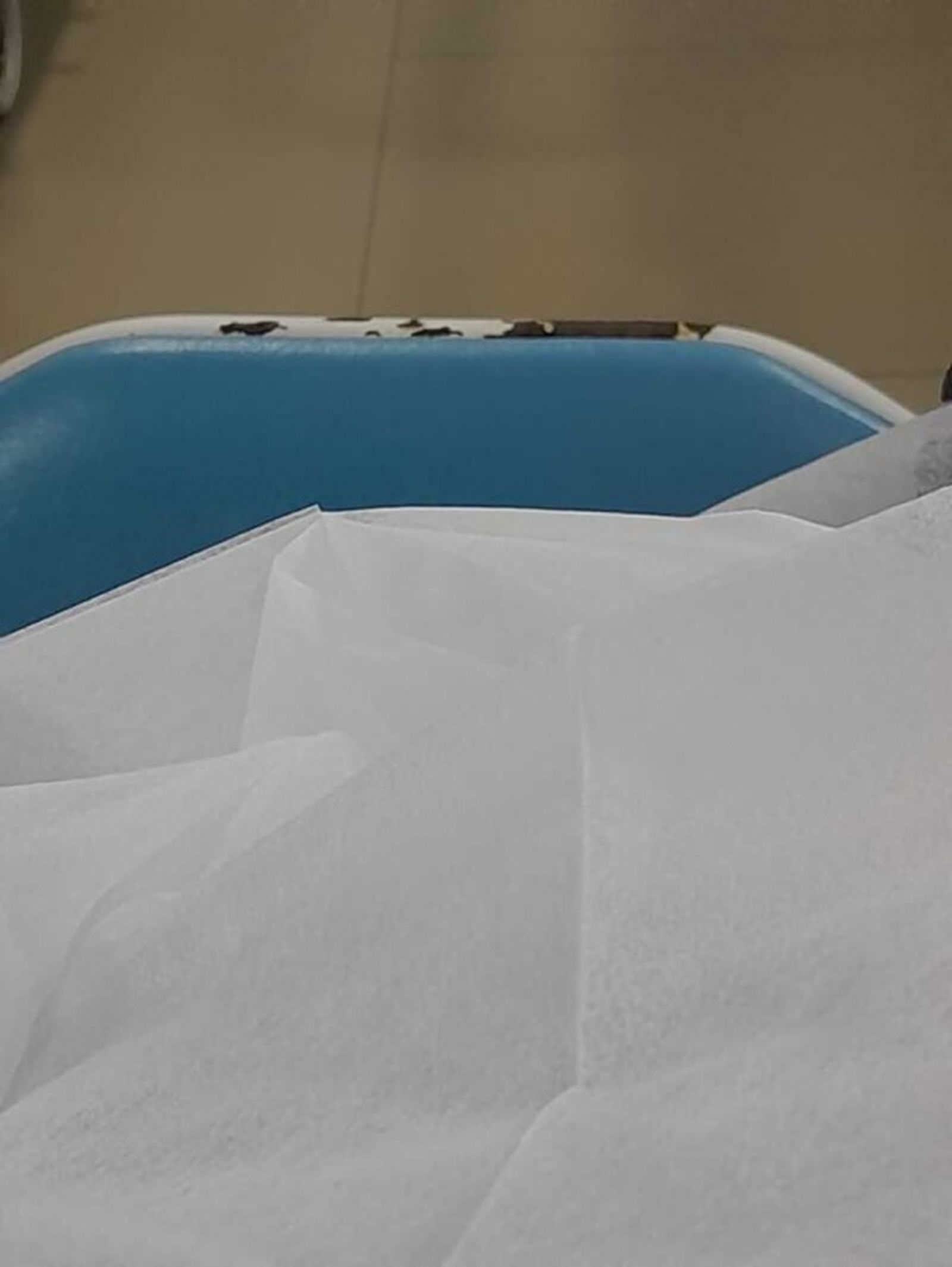 Sillones con óxido en el centro de diálisis RTS-Ceuta. / FOTO CEDIDA